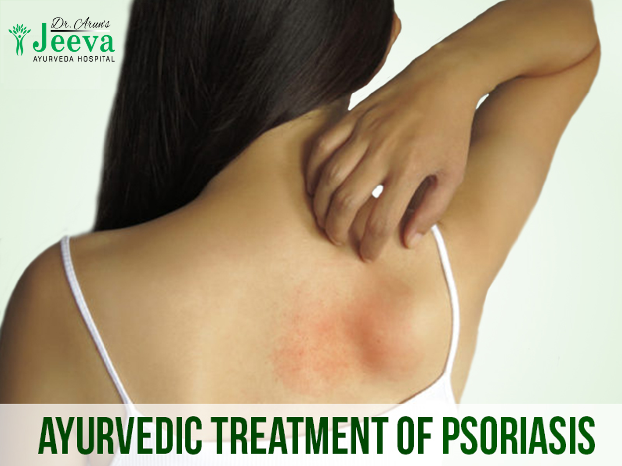 PSORIASIS AND OTHER SKIN DISEASES