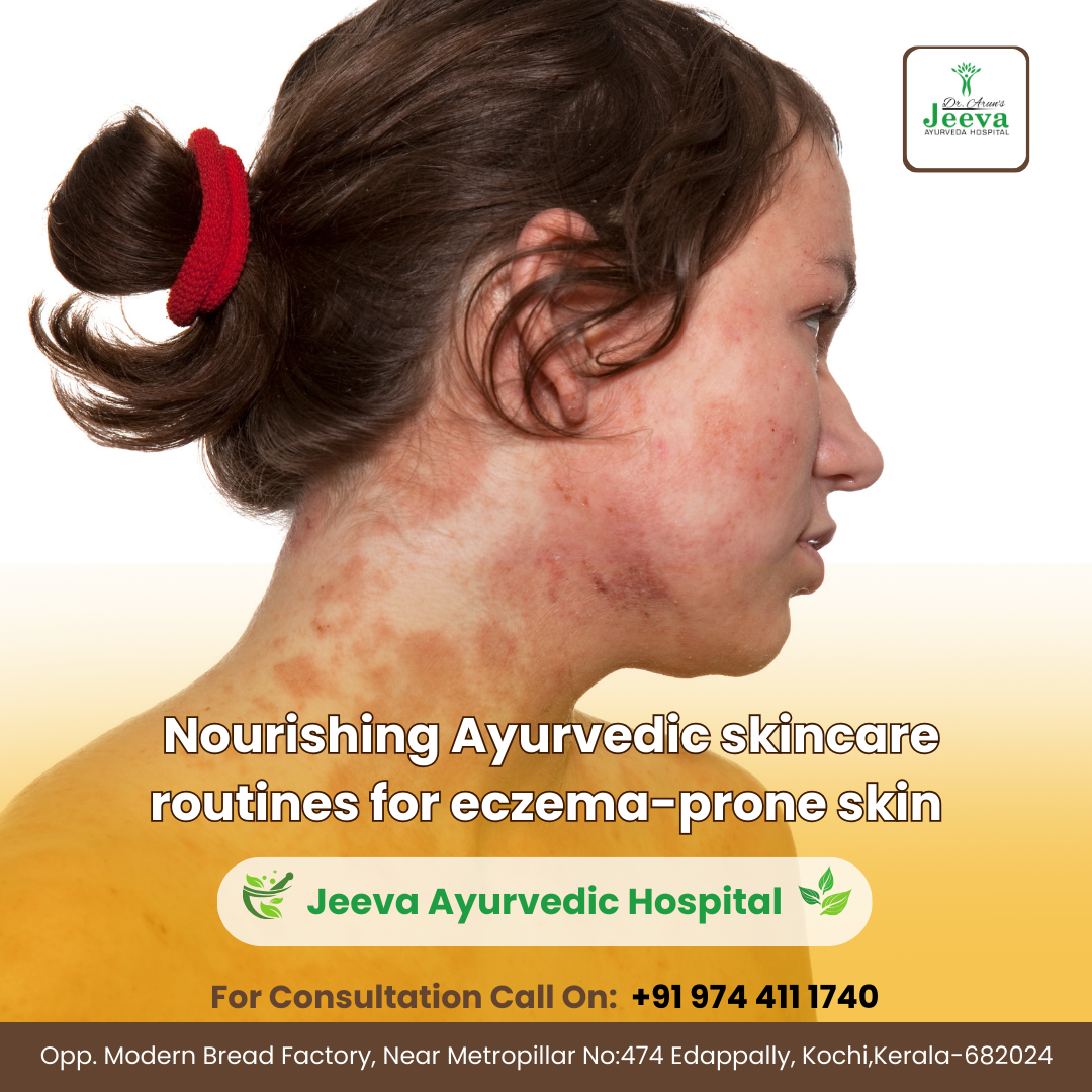 Ayurvedic skincare for eczema